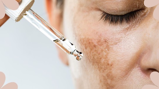 What is the Fastest Way to Cure Hyperpigmentation by The Skin Esthetic