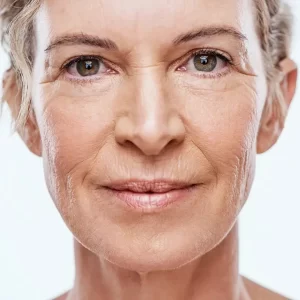 What is the Best Treatment for Wrinkles and Sagging Skin by The Skin Esthetic