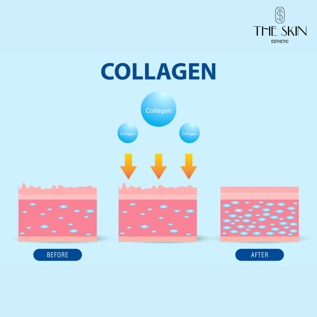 What Is Collagen? - The Skin Esthetic