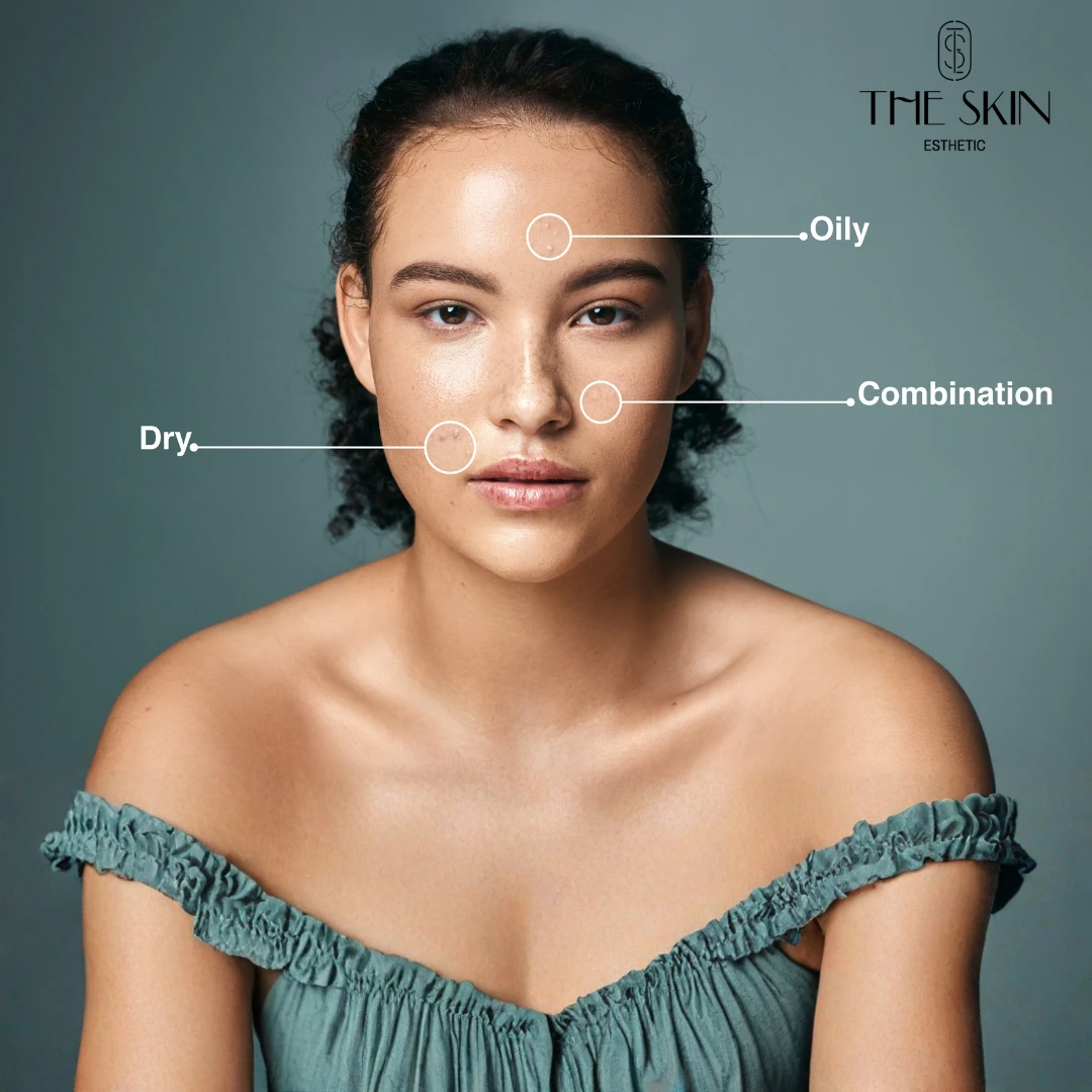 Different Skin Types - The Skin Esthetic